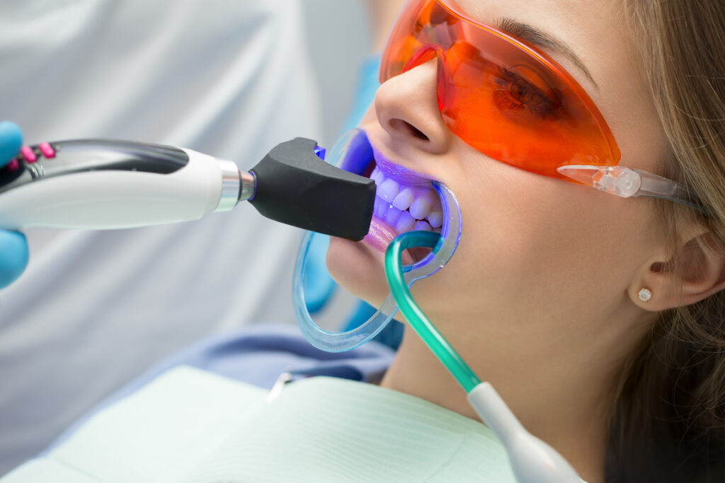 a woman doing teeth whitening